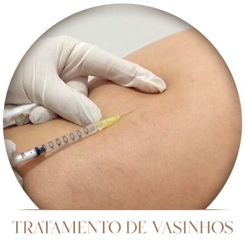 Tratamento de Vasinhos